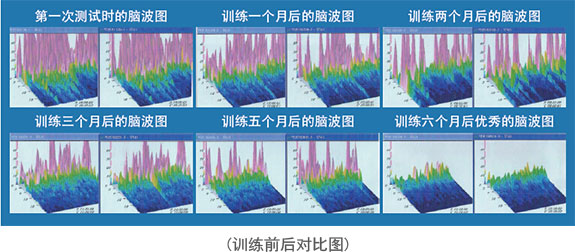 neuroharmony脑波仪